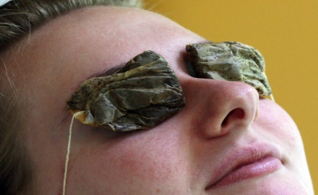 Warm tea bags containing tea leaves help releive a eye stye or hordeolum on the eyelid